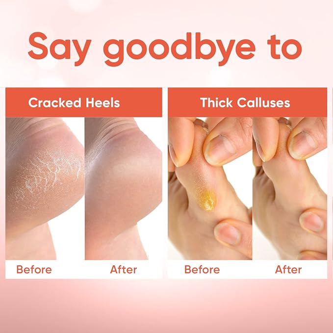 CÉLOR Foot Peeling Mask for Dry Cracked Feet | Foot Mask to Exfoliate Rough - Image 5