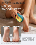BEZOX Glass Foot Scrubber – Professional Foot File Callus Remover - Image 3