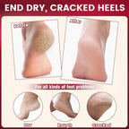 TEAWOO 2 Pcs Cracked Heel Treatment & Repair Stick Set – Rose Oil Infused - Image 3