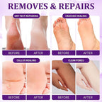 Pedicure Kit Foot Soak Set: Bubble Salt, Sugar Scrub, Massage Mask, Massage - Image 3