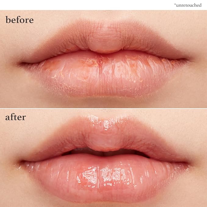 NOONI Vegan Applebutter Lip Mask Overnight – Hydrating Lip Balm & Butter - Image 3