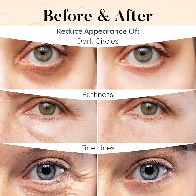 BLOOMORA Caffeine Under Eye Patches, Under Eye Mask - Image 4