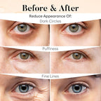 BLOOMORA Caffeine Under Eye Patches, Under Eye Mask - Image 4