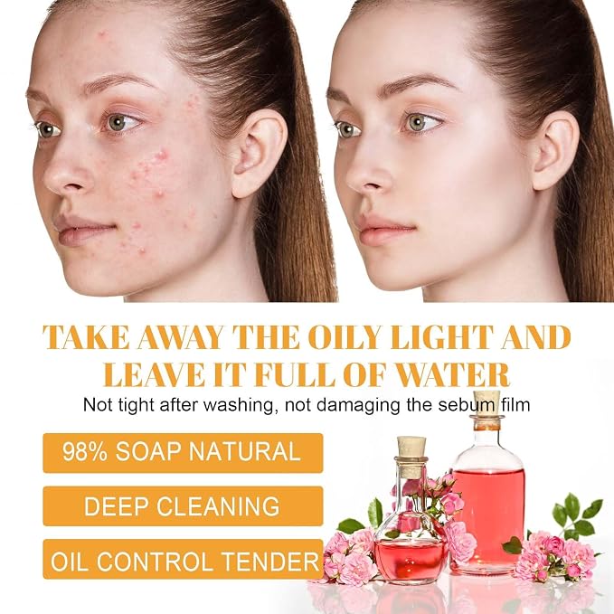 2 Pcs Turmeric Facial Cleanser, Glow Wash Turmeric Face Wash - Image 7