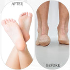 8 PCS Foot File, Callus Remover - Image 7