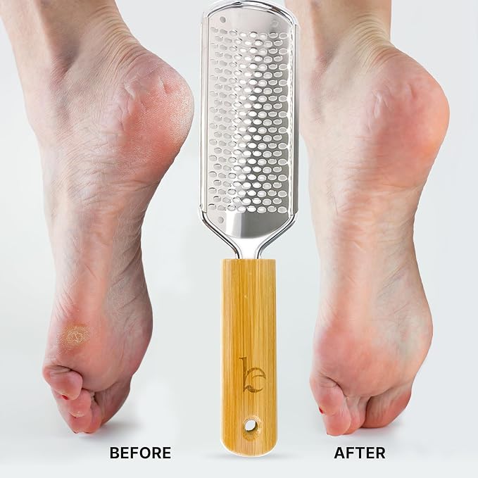 Foot File - Callus Remover Tool - Image 2