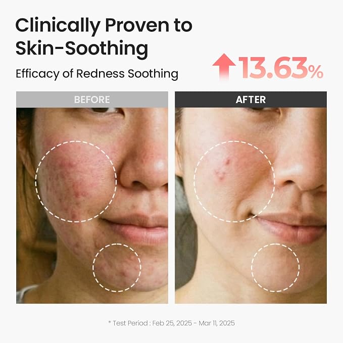 SKINFOOD Peach Cotton Zinc PCA Toner Pads, Korean Skincare - Image 3