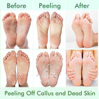 5 Pack Foot Peeling Mask, Exfoliator Peel Off Calluses Dead Skin Callus Remover - Image 4