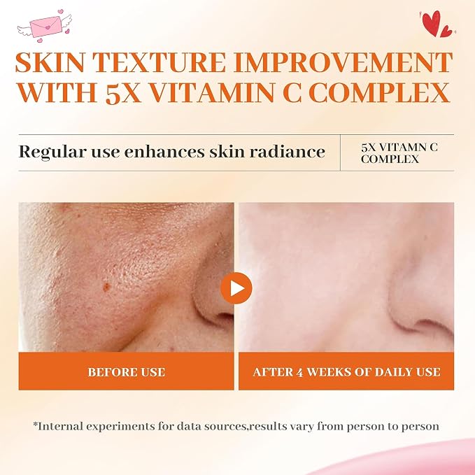 Vitamin C Face Toner 130ml, HONLINK 5X Vitamin C Complex - Image 5