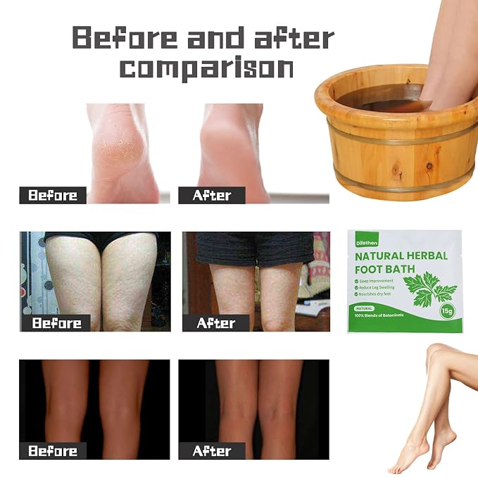 Natural Mugwort/Wormwood Herbal Foot Soak, Lymphatic Ginger Foot Bath Bag - Image 5