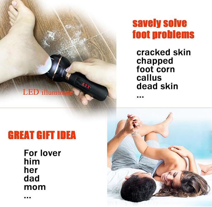 Electric Foot Callus Remover- Long Service Time, Rechargeable Electronic Foot - Image 7