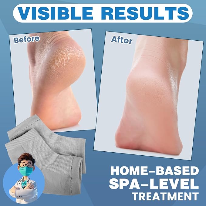 TEAWOO Moisturizing Heel Socks - Image 2