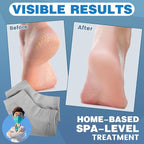 TEAWOO Moisturizing Heel Socks - Image 2