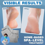 TEAWOO 6 Pairs Moisturizing Heel Socks - Image 2