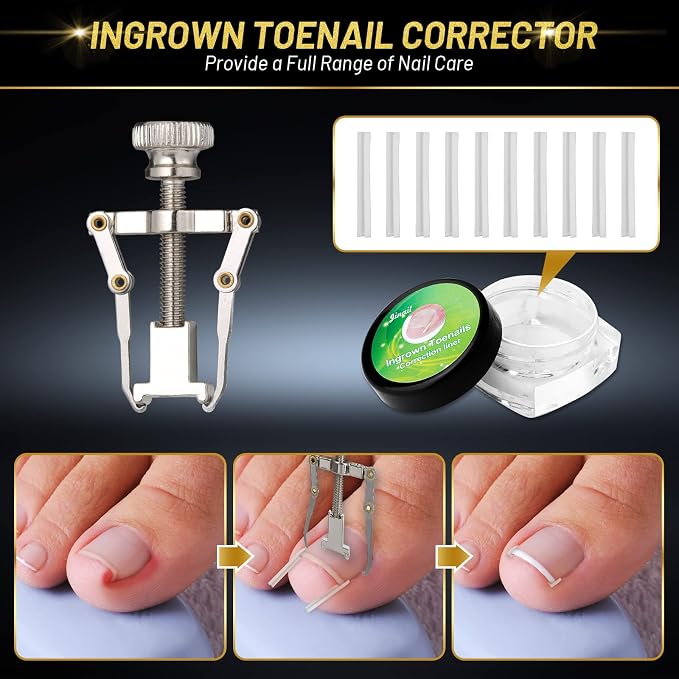 10 PCS Toenail Clippers Tool Kit, Modacraft Professional Podiatrist Nail - Image 5