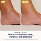 Skinfix Hand Relief Cream - Image 4