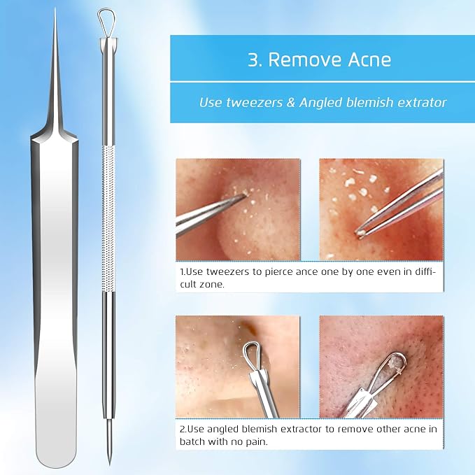 Best Blackhead Remover, Acne Whitehead Removal Kit, Pimple Comedone Extractor - Image 6