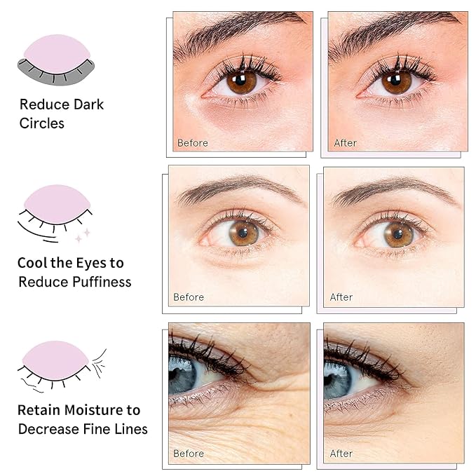AVJONE 24K Gold Under Eye Patches, Collagen Eye Masks - Image 2