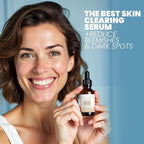 Vitamin C Serum for Face with Retinol & Salicylic 0.83% + Hyaluronic | Skin - Image 8
