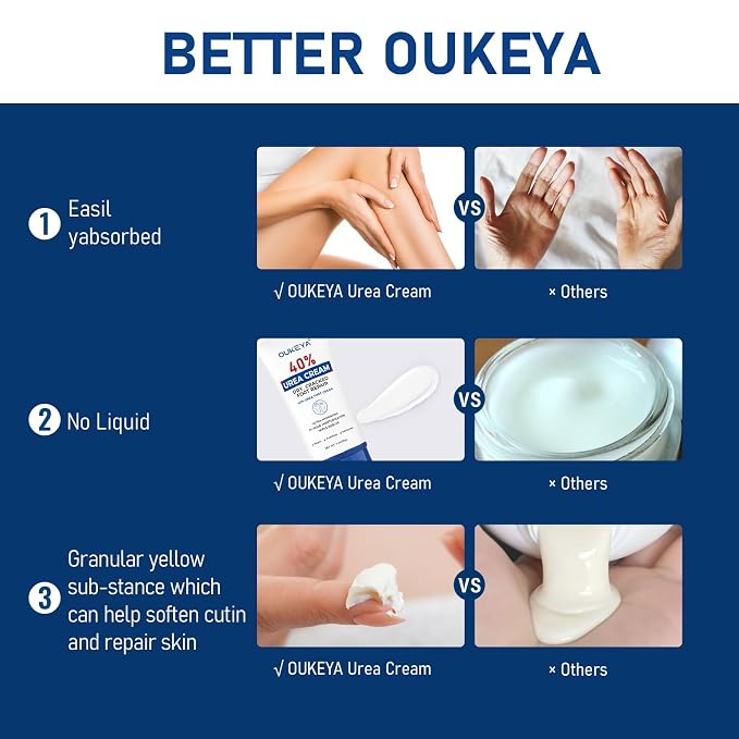 OUKEYA Urea Cream 40 Percent Tube 3 Oz, Foot & Hand Cream - Image 4