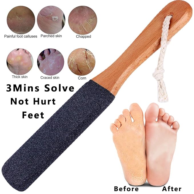 Kinepi Foot File Callus Remover Foot Scrubber, Professional Pedicure Foot Rasp - Image 2
