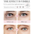 Eakroo Rose Eye Masks - Image 3