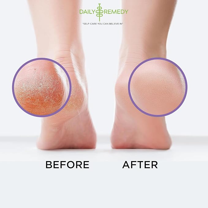 Calming Lavender Foot Soak - Image 5