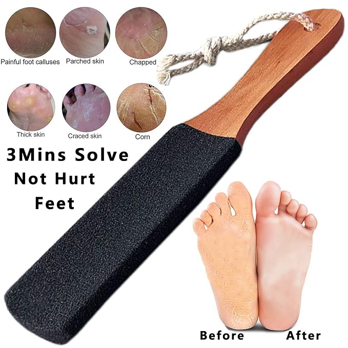 Kinepi Foot Scrubber Pedicure Foot File Pumice Stone, Professional Pedicure - Image 2