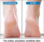 Foot Pumice Stone 2 Pack Pedicure Stone - Image 4