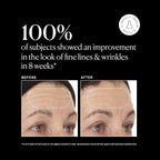 Naturium Vitamin C Super Serum Plus, Smoothing Face Care, plus Retinol - Image 4