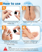 MQFORU Liquid Corn & Callus Removers - Image 3