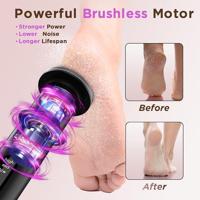 Electric Foot Callus Remover - Image 4