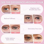 Under Eyes Patches, 40 Pairs Rose Hydrogel Eye Mask - Image 6