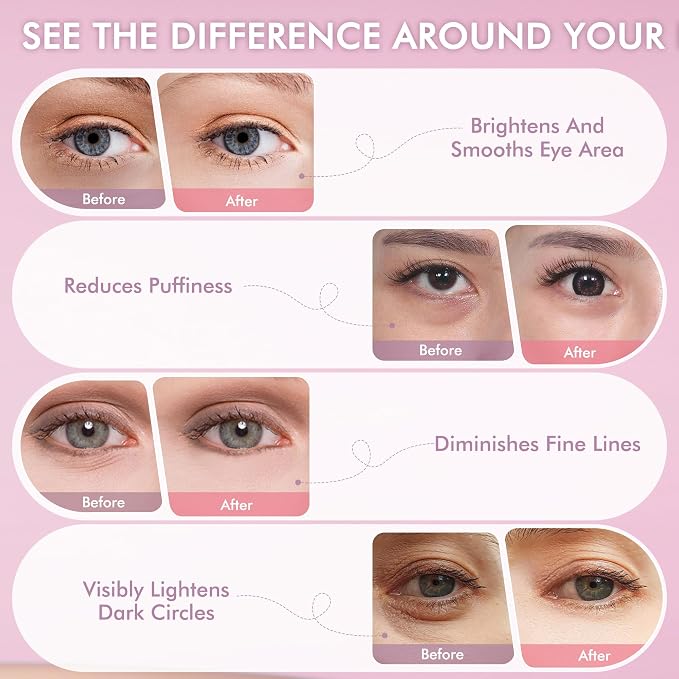 Under Eyes Patches, 40 Pairs Rose Hydrogel Eye Mask - Image 6