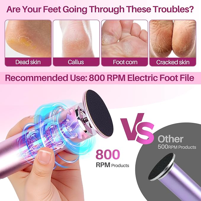 LIONVISON Electric Foot Callus Remover: Adjustable Speed Foot File - Image 5
