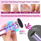 LIONVISON Electric Foot Callus Remover: Adjustable Speed Foot File - Image 5