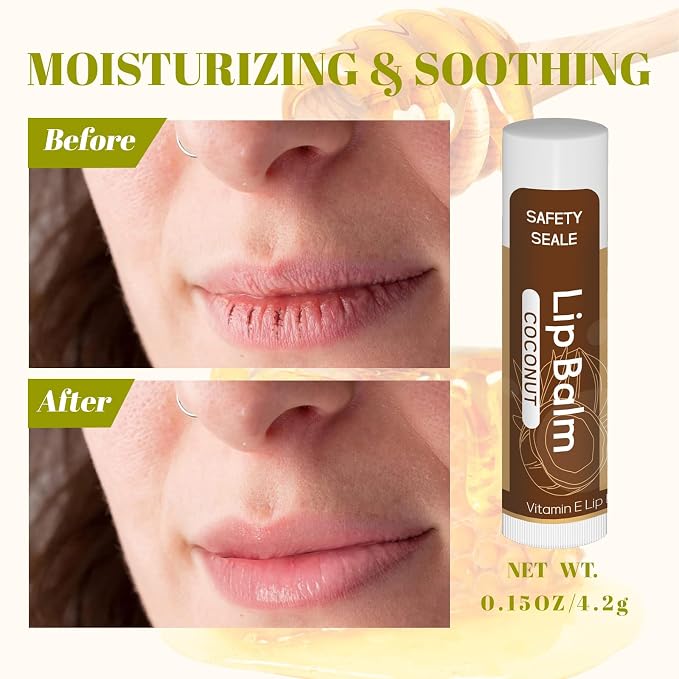 Yopela 36 Pack Natural Lip Balm Bulk - Image 6
