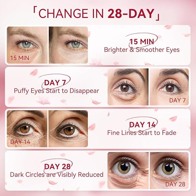 BREYLEE Rose Eye Mask– 60 Pcs, Under Eye Patches, Patches - Image 6
