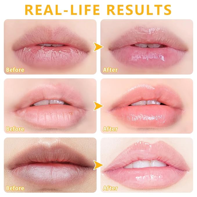 5 PCs Bee Balm Lip Mask, Moisturizing Lip Balm & Scrubs, Prevents Dry & Cracked - Image 4