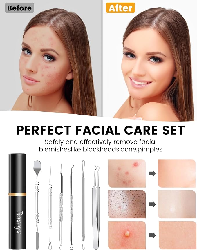 Pimple Popper Tool Kit - Image 6