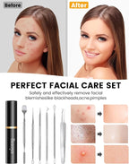 Pimple Popper Tool Kit - Image 6
