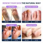 FOOT CURE Soothing Lavender Foot Spa - Image 4