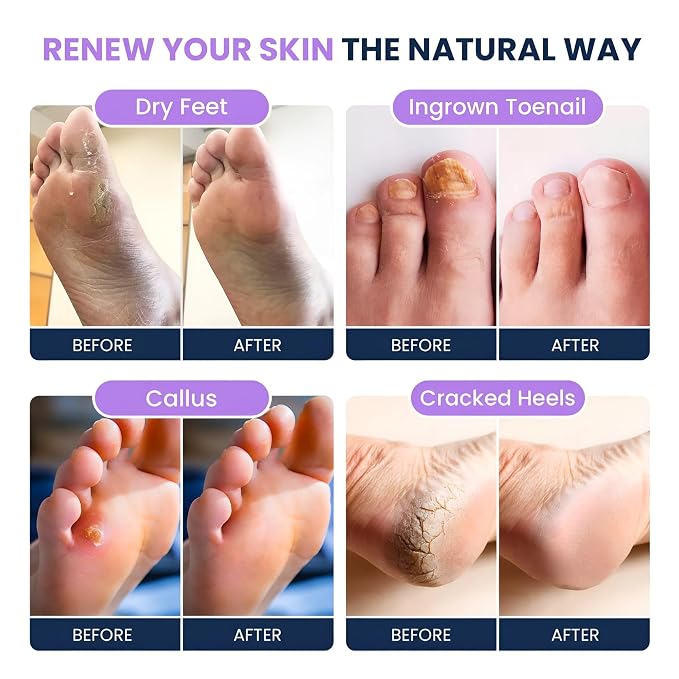 FOOT CURE Soothing Lavender Foot Spa - Image 4