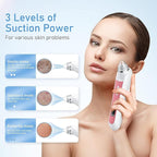 Blackhead Remover Vacuum, USB Interface Type Pore Vacuum, Men and Women Pore - Image 5