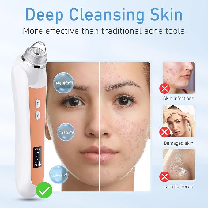 Facial Pore Blackhead Remover Vacuum, 1080P Camera Blackhead Remover, 20x Zoom - Image 4