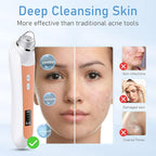 Facial Pore Blackhead Remover Vacuum, 1080P Camera Blackhead Remover, 20x Zoom - Image 4