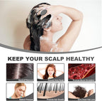 Meartchy Silicone Scalp Massager, Scalp Scrubber - Image 4