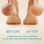 Lee Beauty 8oz Professional Gel Callus Remover - Image 2