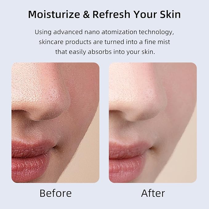 Microtree Nano Facial Steamer - Image 3