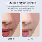 Microtree Nano Facial Steamer - Image 3